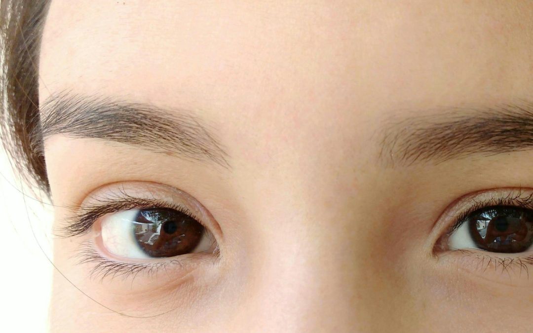 Augenringe unterspritzen: Vorher-Nachher Transformation